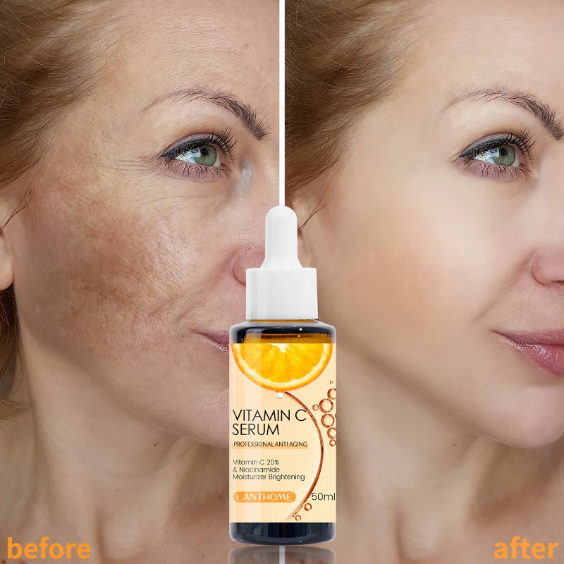 

20% Vitamin C Serum Hyaluronic Acid Retinol Acne Treatment for Face Eyes,Dark Spots,Wrinkles,for Men Women Brightening Skin Care