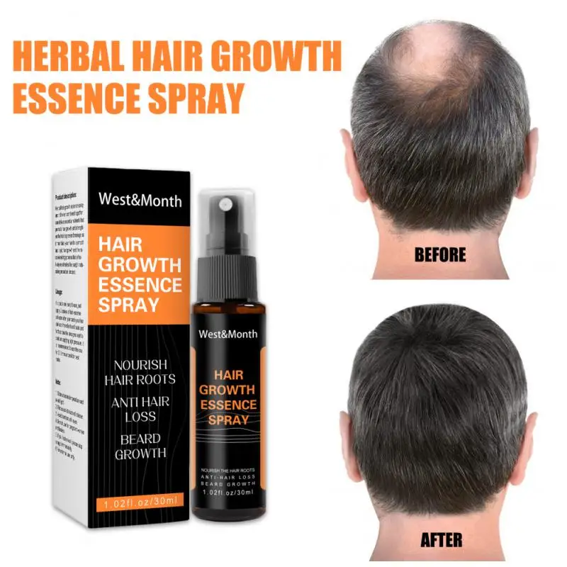 

30ml Ginger Hair Growth Spray Serum Anti Hair Loss Products Fast Regrowth Nourishing Soften Scalp Repair Dry Damaged Hair Care