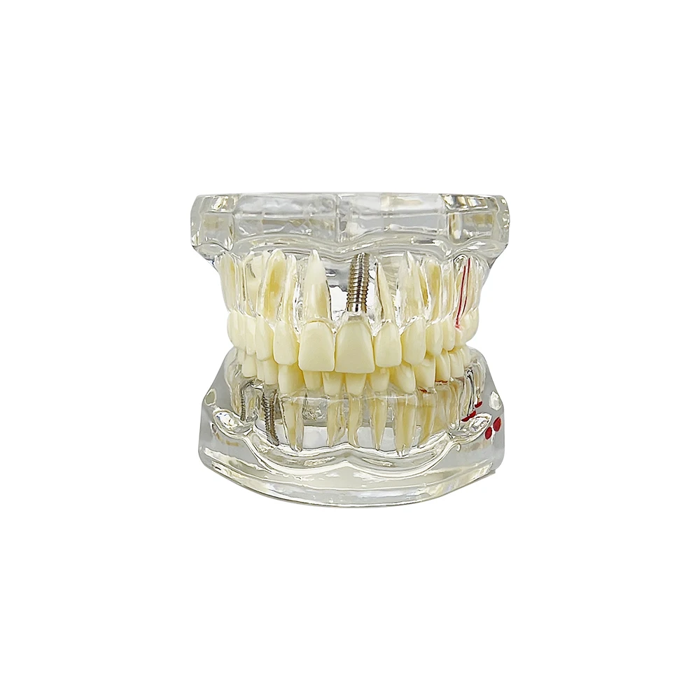 Модель для коррекции зубов прозрачная модель стоматолога студенческая практика