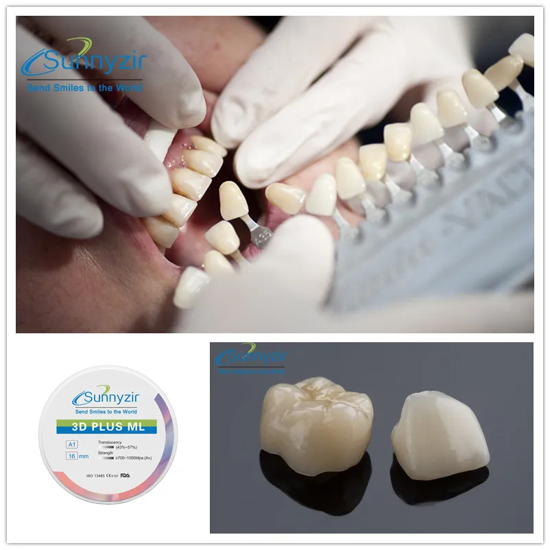 Sunnyzir 3D +/Pro/Plus High Translucency Multilayer Zirconia Blocks 98mm B4 For Dental Cad Cam High Strength Ceramics Materials