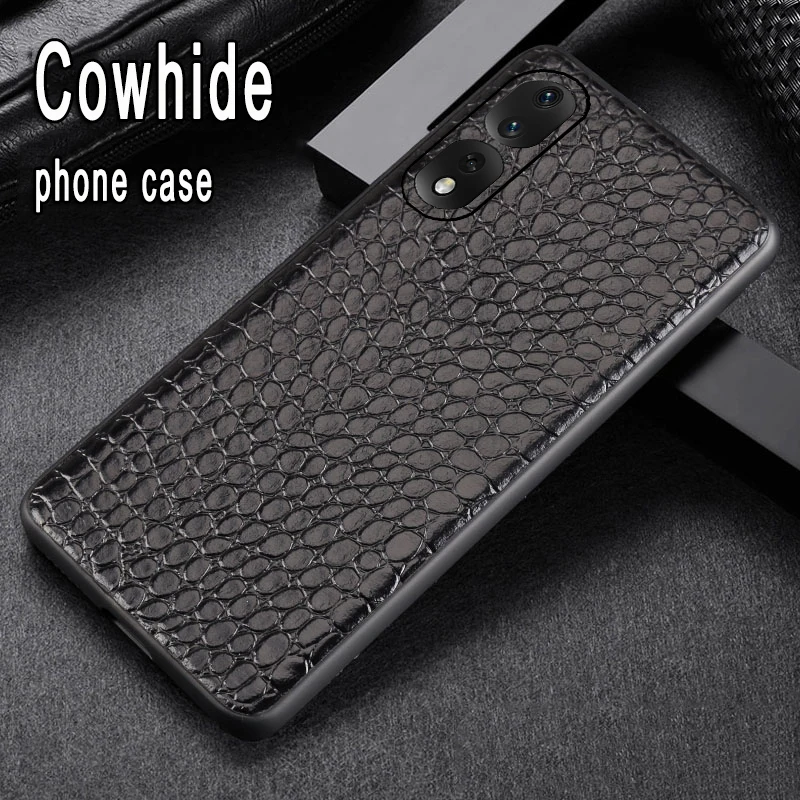 

Funda for Honor 80 70 60 50 Pro magic 4Pro luxury Full protective Leather phone case Shockproof Back cover For mate 50RS case