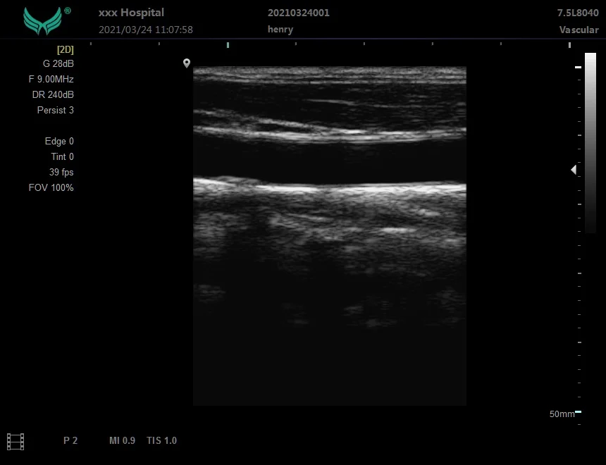 Ноутбук YD-P20 B/W ультразвуковая диагностическая система портативная цена