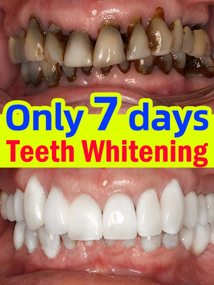 

Whitening mousse Removes tartar and stains Neutralizes yellow tones Fresh breath Whitens teeth Daily oral care