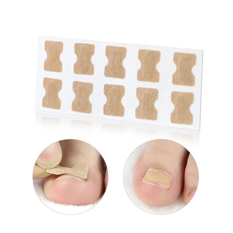 

50pcs Ingrown Toenail Corrector Patches Toenail Correction Stickers to Relieve Nail Groove Paronychia Treatment Patch Foot Care