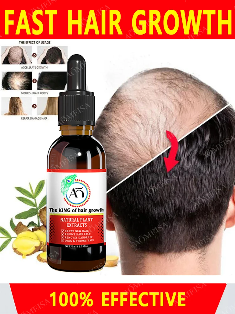 

Hair Growth Oil Fast Hair Growth Effective Baldness Repair Hereditary Hair Loss Postpartum Hair Loss Seborrheic Hair Loss