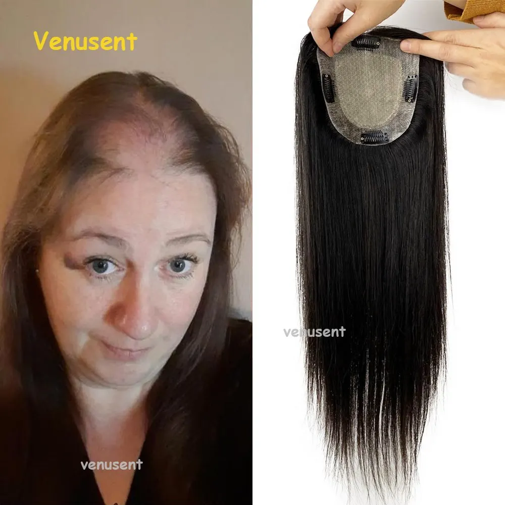 Virgin Human Hair PU Topper for Bald Hair Natural Scalp Silk Top 13X13CM Women Toupee Toppers Straight Hair Piece with 2cm PU