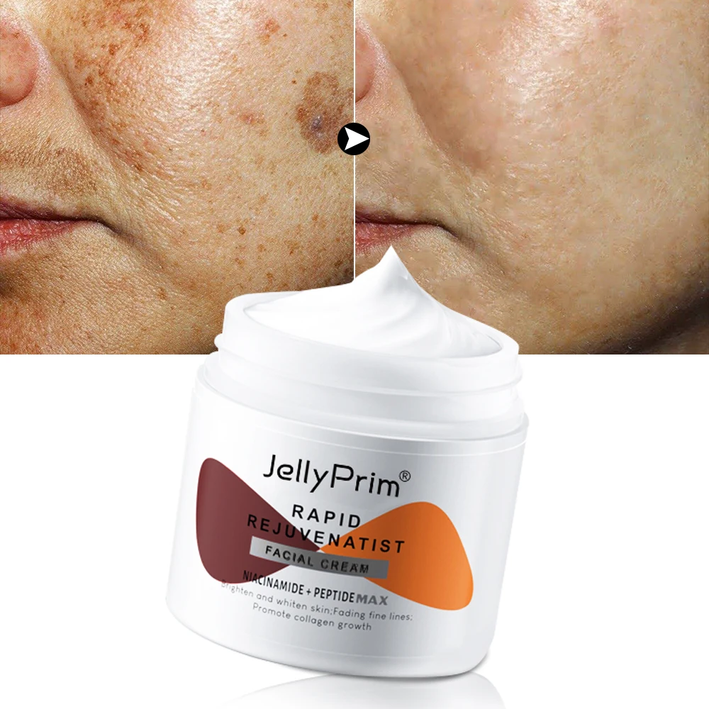 Nicotinamide Dark Spots Whitening Cream Pigment Remover Lightening Creams Skin Whitener Care Women Facial Moisturizing Products