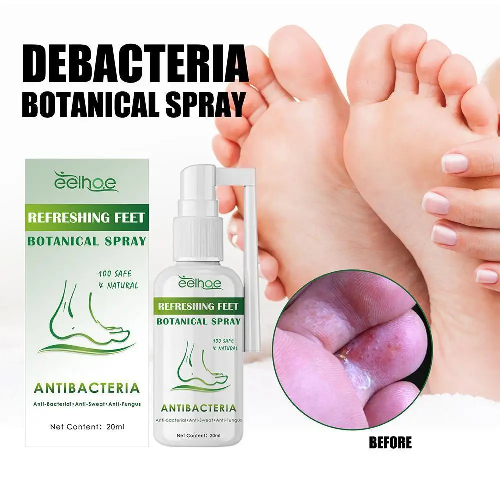 

Anti Fungal Spray Foot Fungal Cream Relieve Beriberi Toe Treatment Gel For Cracked Heel Peeling Blister Repairing Feet Oint Q6y1