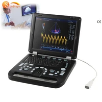 4d 3d high end laptop cw color doppler medical msk ultrasound echo machine