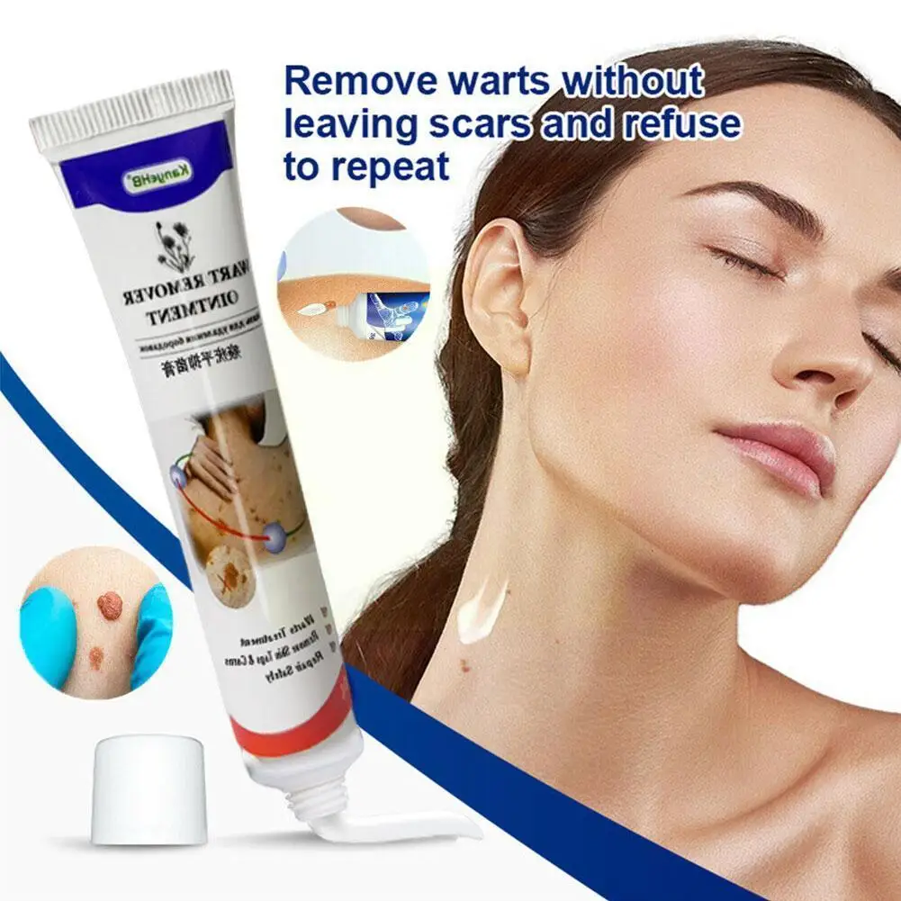 20g Warts Remover Cream Antibacterial Ointment Wart Ointment Skin Micro Kill Skin Treatment Genital Tag Remover Wart Mole Cream