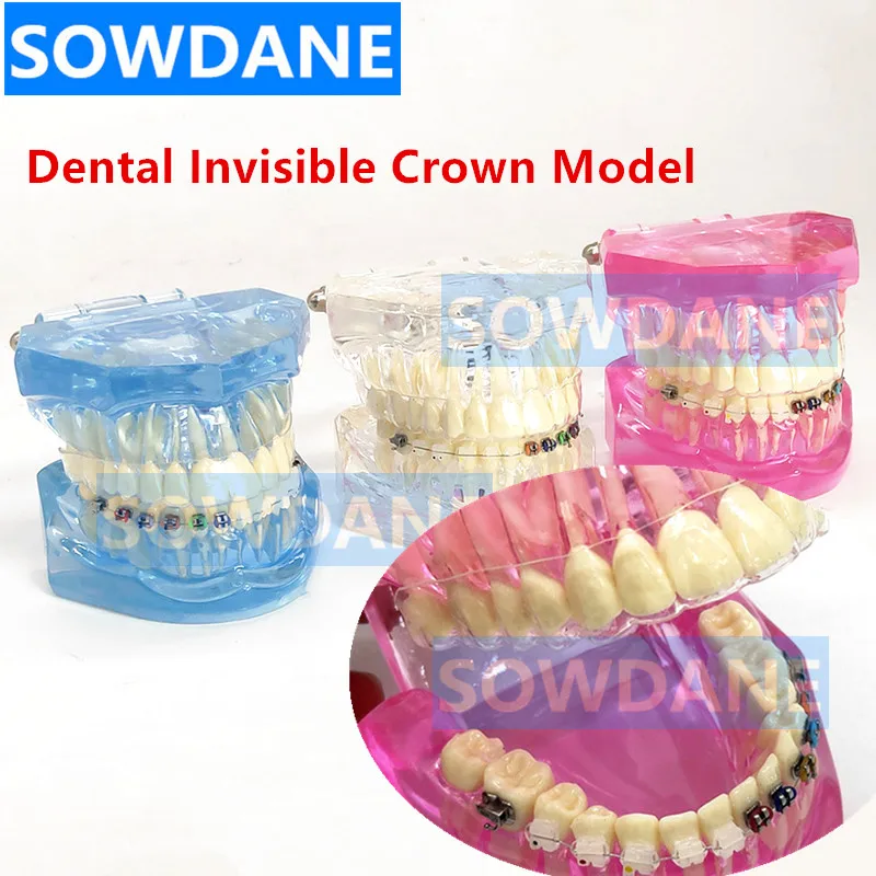 Новая Стоматологическая Ортодонтическая модель зубов для общения с пациентом