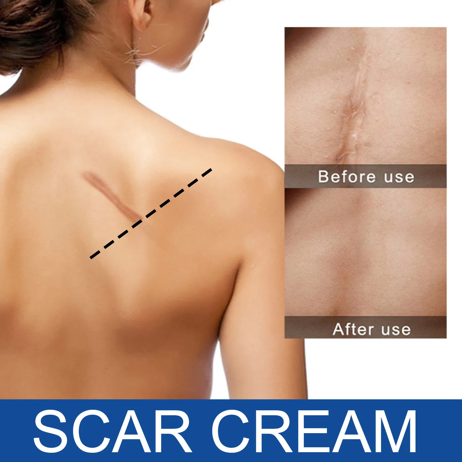 Desalt scar repair cream scald burn old scar acne mark operation scar smooth skin scar repair desalt cream skin repair cream