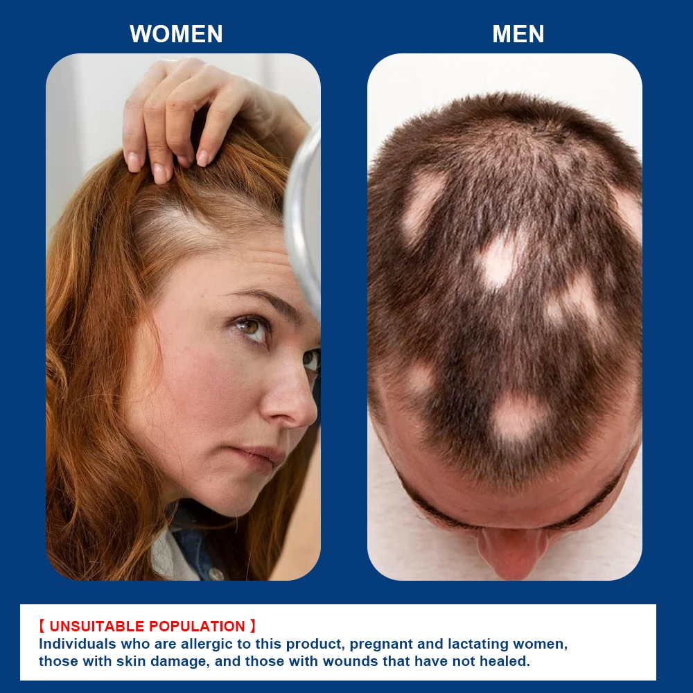 1/3/5/10/15/20/30 шт.