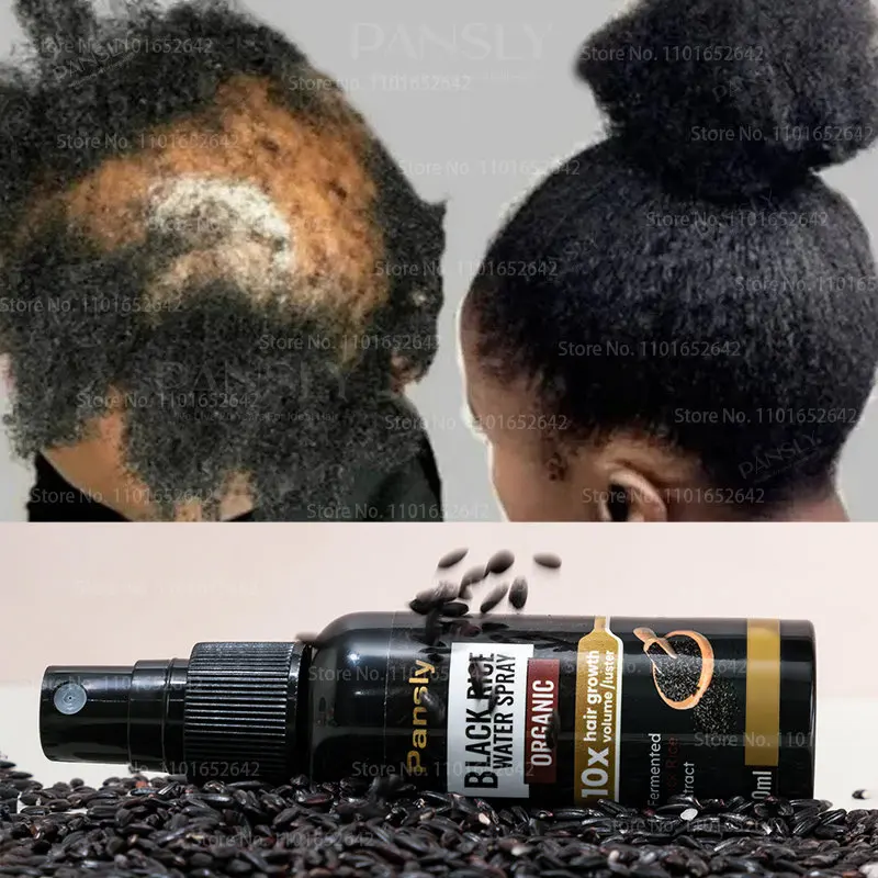 

Black Rice Hair Growth Spray Repairs Damage Restore Soft Hair for All Hair Types Fast Treatment Prevent Hair Thinning Dry Repair