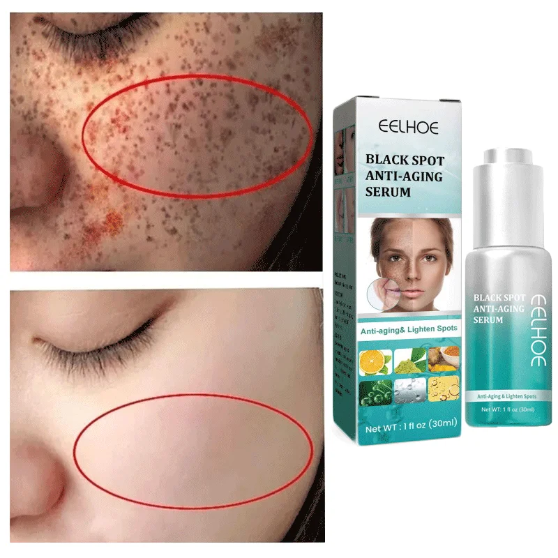 

Effective Whitening Freckles Cream Effective Remove Melasma Remove Dark Spots Lighten Melanin Moisturize Smooth Brighten Face Ca