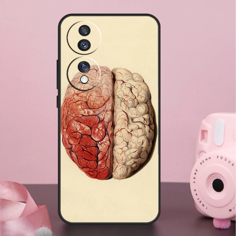 Чехол для Honor X9a X8a X7a X6a X7 X8 X9 X9b X8b 10 50 70 90 Lite Magic 6 5 Pro