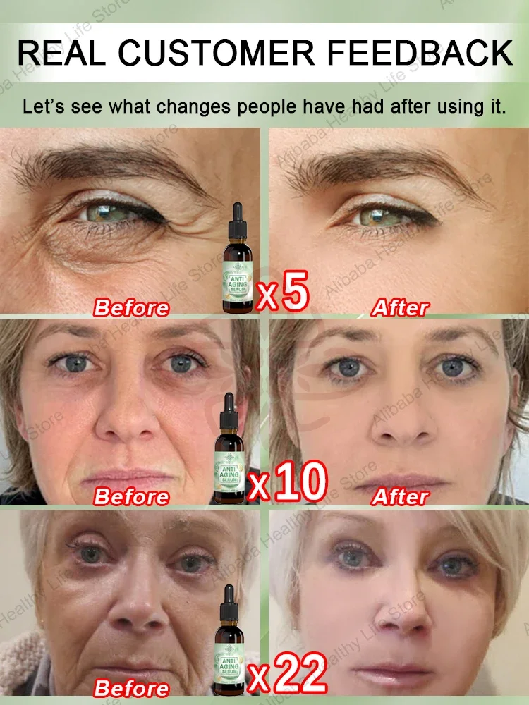 Разблокировать молодежный код и оставьте без следов времени