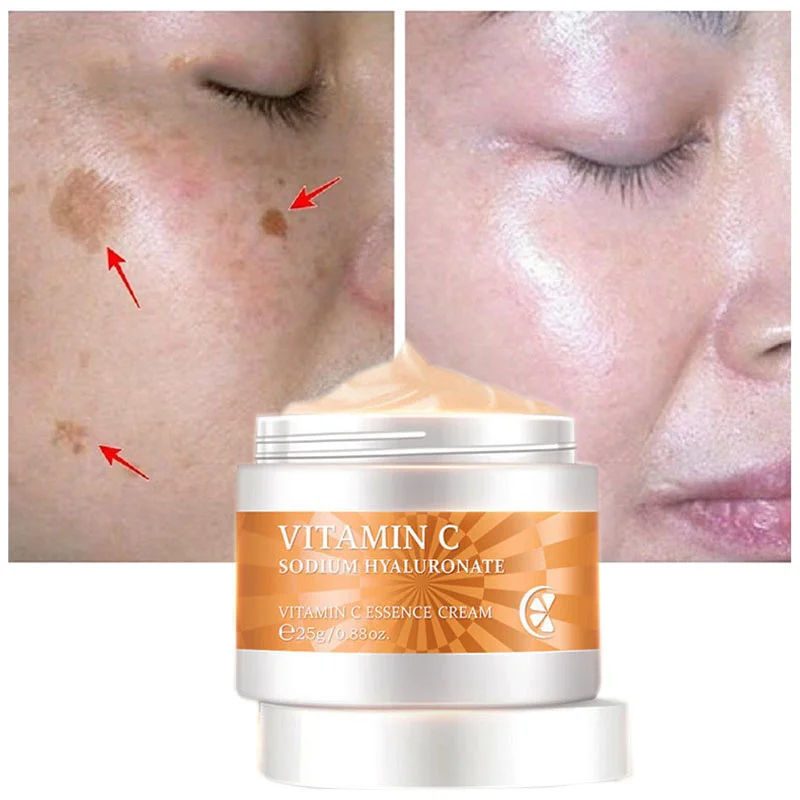 

Vitamin C Whitening Cream To Dark Spots Fade Freckles Melanin Hyaluronic Acid Anti-aging Moisturizing Brightening Face Skin Care