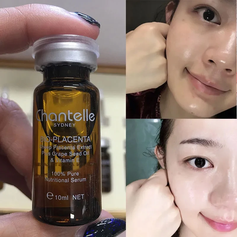 

Australia Chantelle Gold Bio Placenta Serum Pure Sheep Placenta Grape-Seed VE for Age Spots Pigmentation Scars Skin Radiance