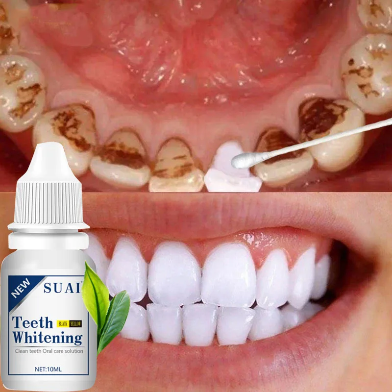 

Teeth Whitening Serum Remover Plaque Stains Dental Bleach Essence Oral Hygiene Cleaning Tools Fresh Breath Tooth Whitener Care