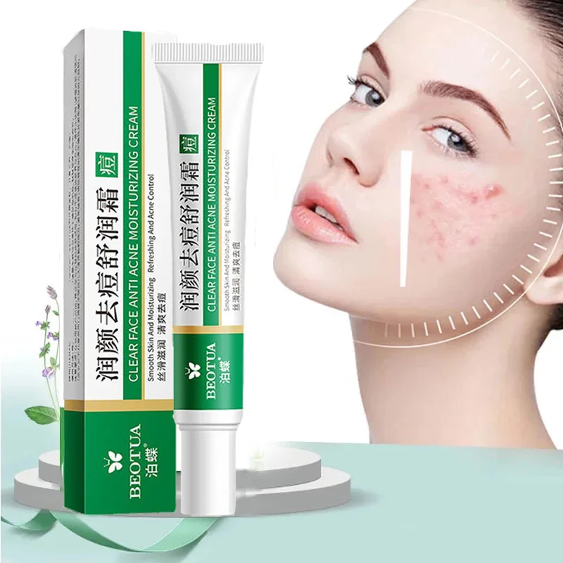 

Effective Acne Removal Cream Herbal Acne Spots Oil Control Acne Cream Skin Care Whitening Moisturizing Face Gel Skin Care 20g