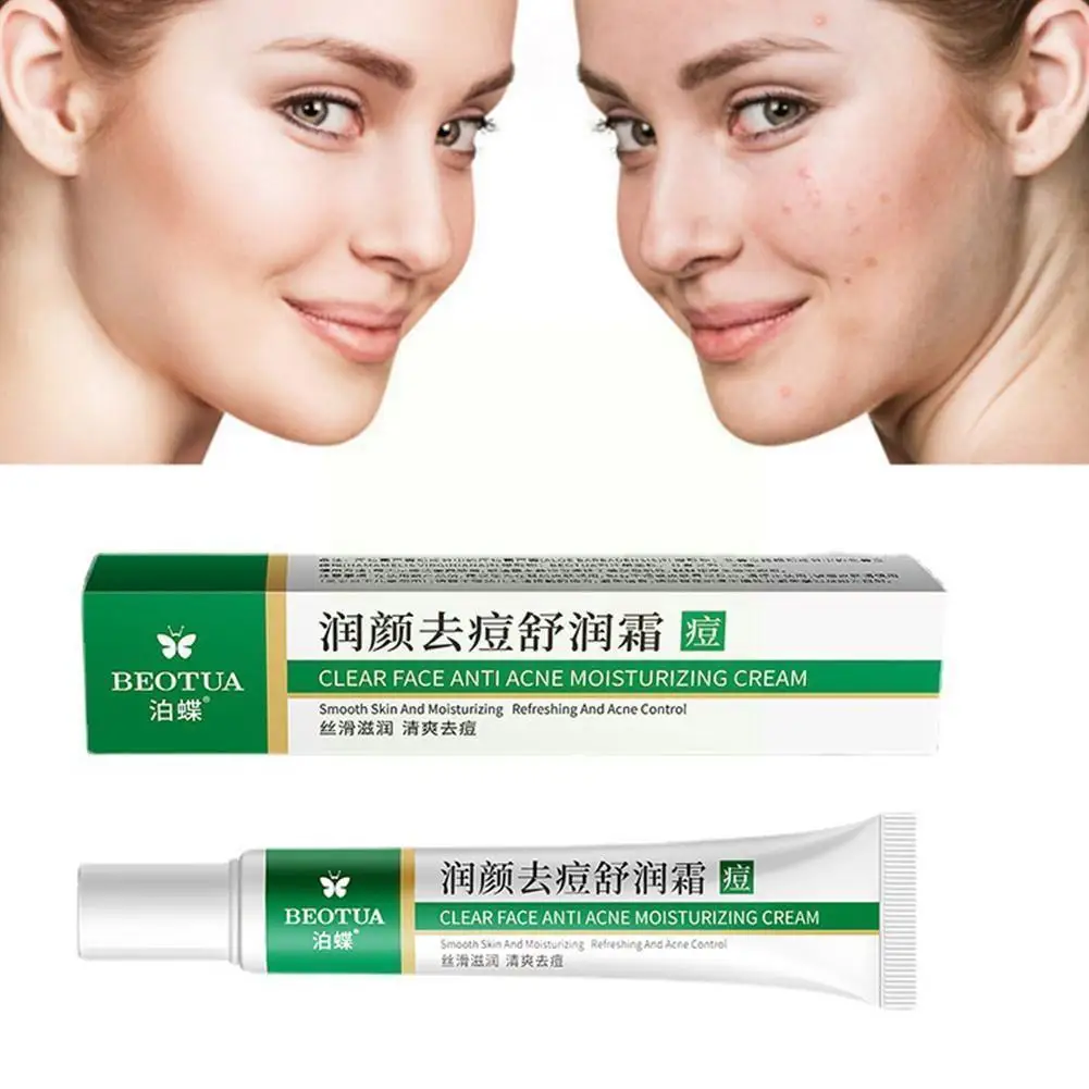 

Acne Removal Oil Control Aloe Vera Moisturizing Whitening Shrink Skin Spot Gentle Makeup Care Gel Anti-aging Pores Fade 20g B1W3