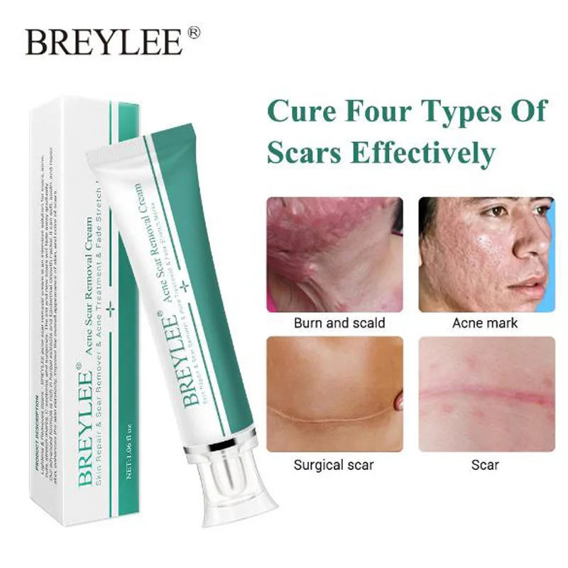 

BREYLEE Scar Removal Cream Stretch Marks Removal Acne Scars Skin Repair Whitening Cream Dark Spot Remover For Face Skin Care
