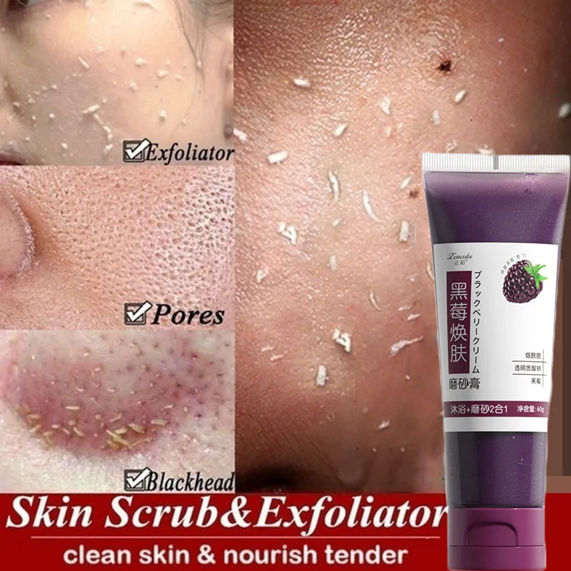 Exfoliating Cream Exfoliating Gel Peeling Dead Skin Removal Facial Scrub Cleaner Acne Blackhead Treatment Whitenin Beauty Health