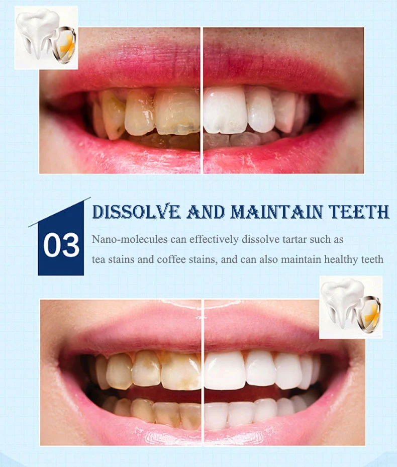 Ручка для отбеливания зубов гель гигиены полости рта чистящий отбеливающий