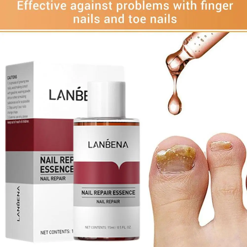 LANBENA Уход за грибком Удаление онихомикоза пальцев Питание ногтей Ноги Пепреры
