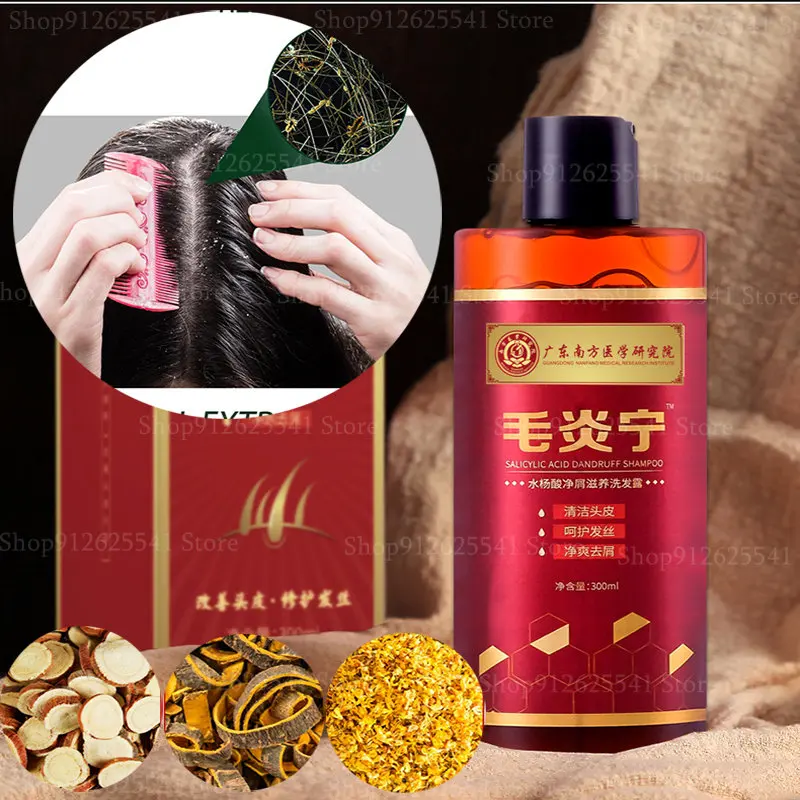 

300ML Remove Dandruff Control Itching Antipruritic Shampoo Chinese Herbal Anti-Dandruff Anti-Itch Shampoo Oil-control Refreshing