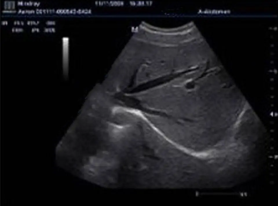 Mindray V11-3 V11-3HE 6CV1P Endocavity выпуклый зонд изогнутый массив ультразвуковые