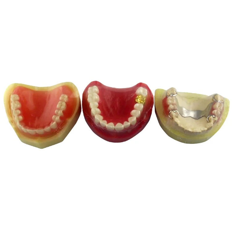 

A set includes 3 models dental prosthodontic model