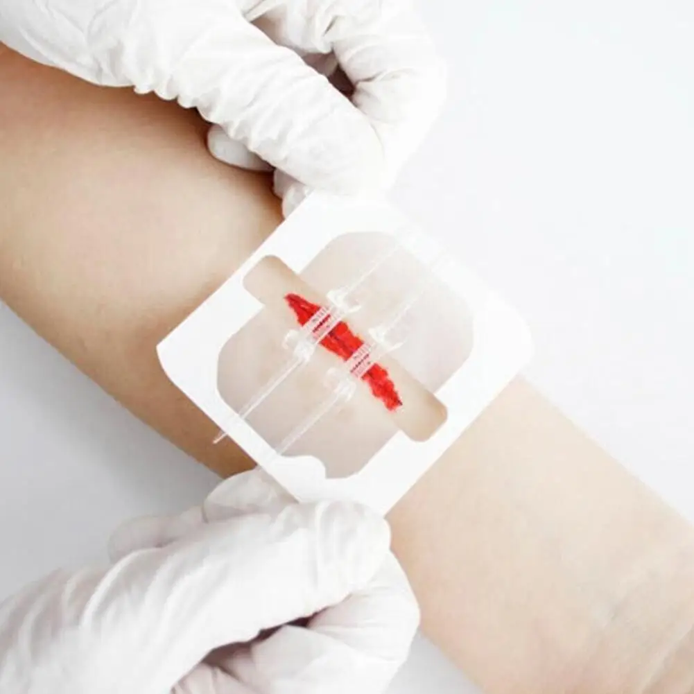

2pieces Zipper Tie Wound Closure Patch Hemostatic Patch Band-Aids Skin Fast Care Wound Zipper Portable Outdoor Suture 2023 M4A1
