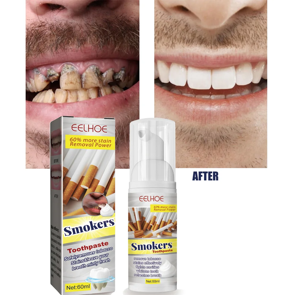 

Repair Bright White Anti-Sensitive Toothpaste Gel Gentle Whitening Toothpaste Remove Smoke Stains Plaque Fresh Breath Teeth Care