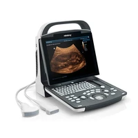 ce best price laptop led price ultrasound scanner laptop ultrasound scanner