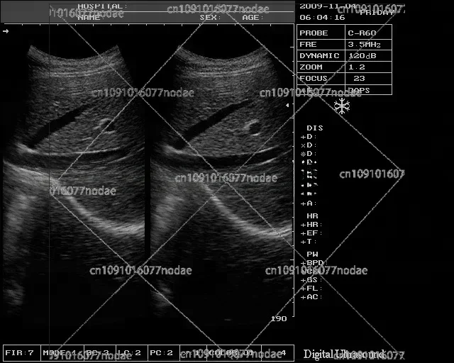 Дешевый ноутбук Ecograph черно-белый ультразвуковой апарат дешевый чем 2D-аппарат Logiq