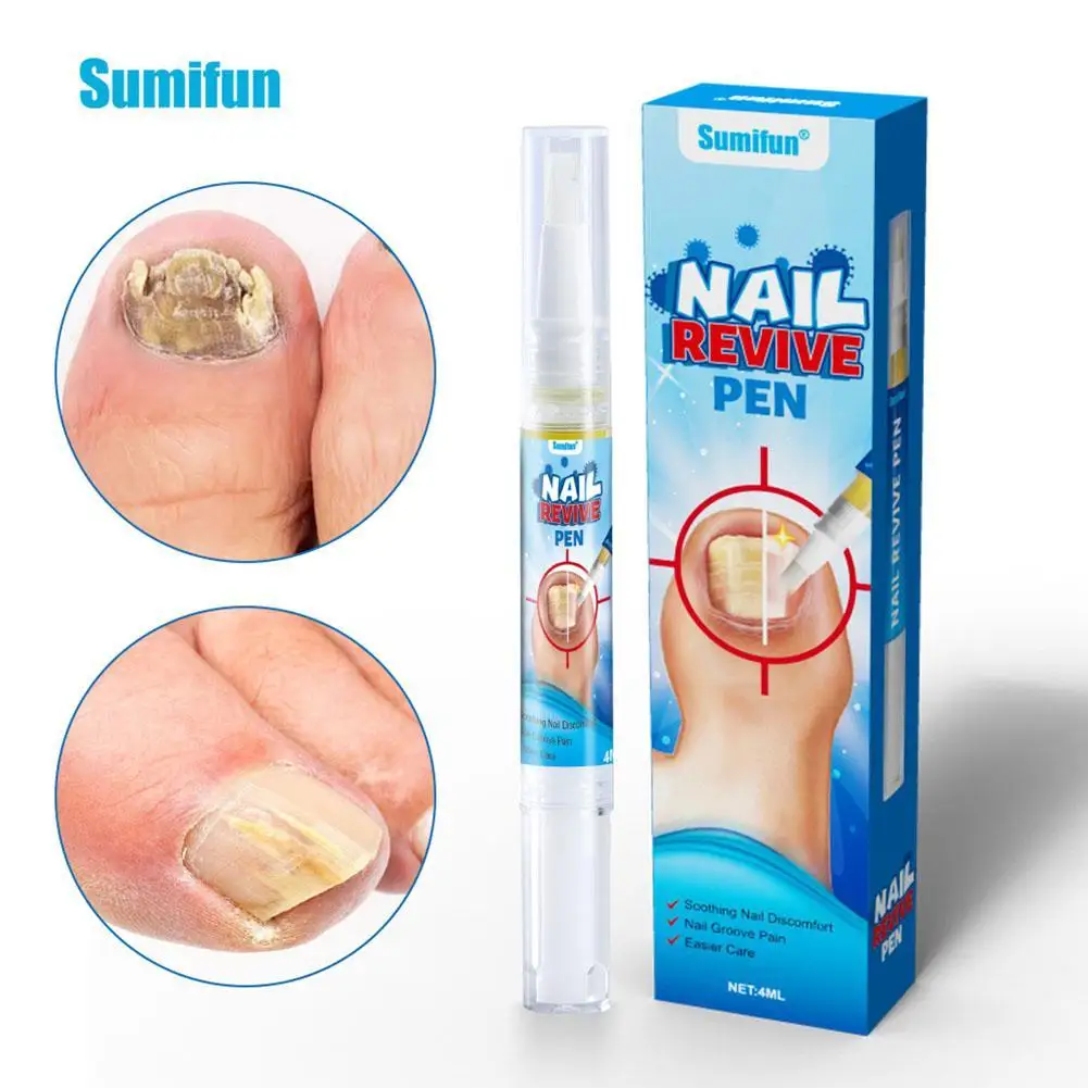 Инструмент для лечения грибка ручка восстановления ногтей лазерная