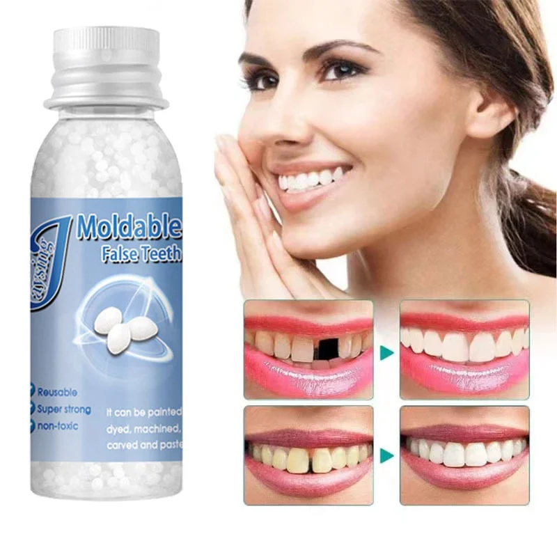 

30g Teeth Gap False teeth Solid Glue Resin Missing Broken Teeth Filling Material Temporary Tooth Repair Set Denture Beauty Tools