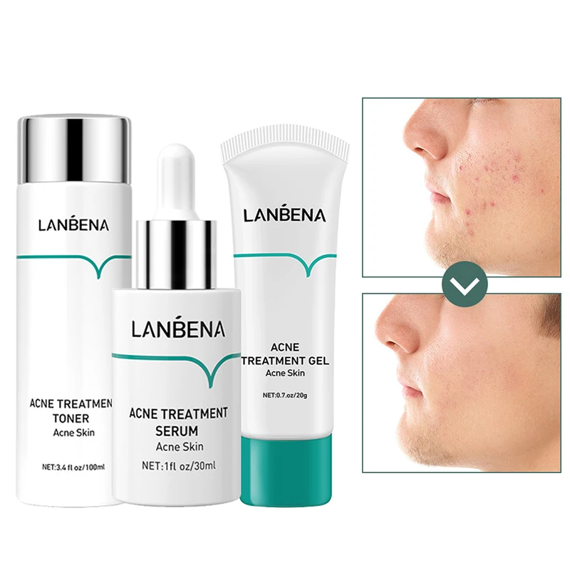 

Набор для лечения акне LANBENA, уход за кожей, лечение акне, восстановление пятен, уменьшение воспалений, уменьшение следов акне, набор для лече...