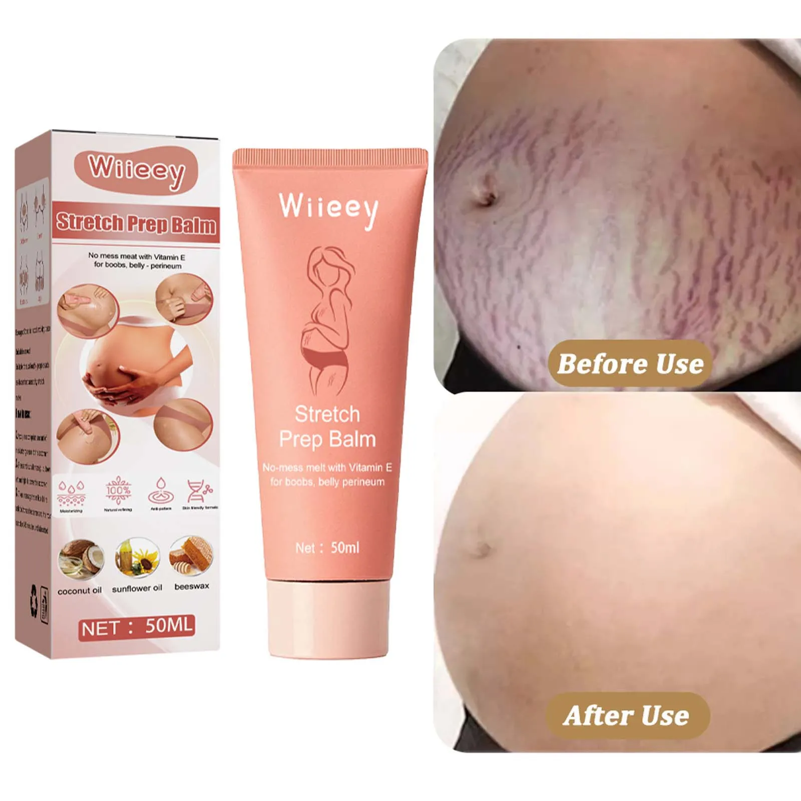 

Effective Pregnant Scar Repair Cream Stretch Marks Removal Women Acne Scars Remove Maternity Fat Striae Gravidarum Body Care