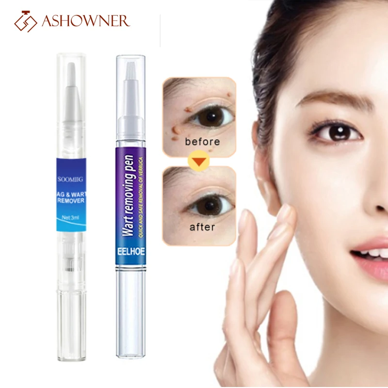 Средство для удаления бородавок с кожей средство от | Красота и здоровье