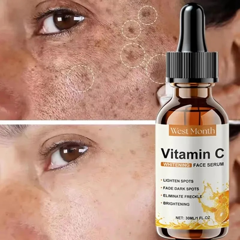 Витамин С отбеливание удаление веснушек блеск лица опреснение желто - коричневое