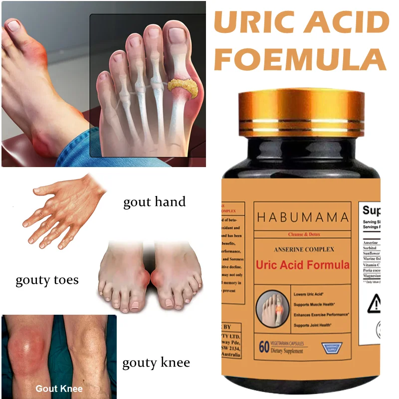 

Arthritis Treatment Gout Relief Capsules Reduce Uric Acid, Relieve Joint Swelling, Inflammation, Pain and Stiffness, Anserine