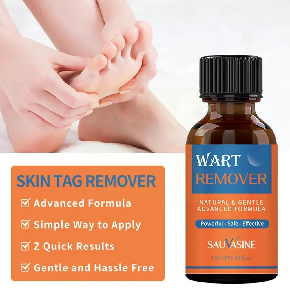 

10ml Wart Removal Liquid Skin Tag Remover Against Mole Skin Removal Treatment & Warts Papillomas Tags From Of Genital Liqui T0y2