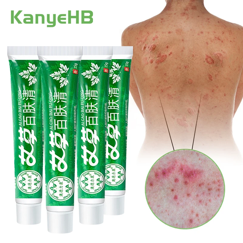 

1-2-4pcs Skin Desquamation Itching Cream Relief Psoriasis Bacteriostatic Eczema Urticaria Dermatitis Redness Treatment Ointment