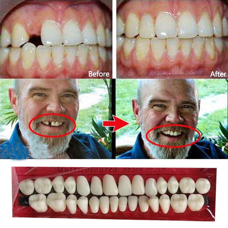 

1Set Teeth Model Durable Dentures Universal Resin False Teeth Material Teeth Teaching Model Dedicated Teeth
