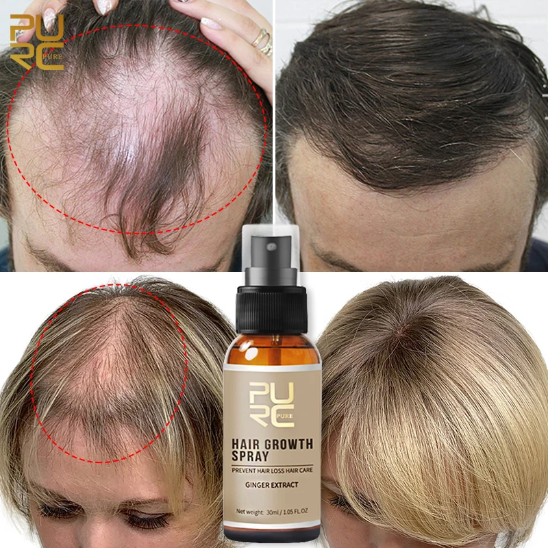 

Ginger Hair Growth Products Anti Hair Loss Spray Fast Growing Hair Essentia Oil Scalp Treatments For Men Women Beauty Health