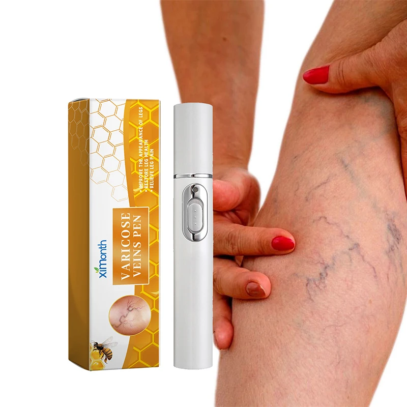 Leg Massage Body Repair Pen Lampshade Therapy For Varicose Veins Effective Relief Fatigue Improved Blood Circulation