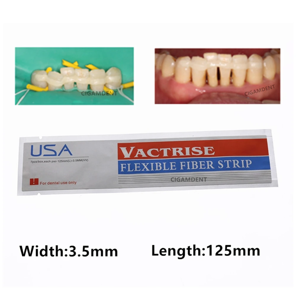 

7Pcs Dental Fiber Splint Glass Flexible Fiber Strip Composite Resin Light Cure Bonding Strips Dentistry Material